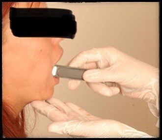 szájnyálkahártya törlet biztosítása DNS mintavevő pálcával